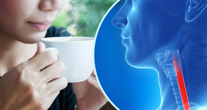 Drinking Hot Cause Esophageal Cancer