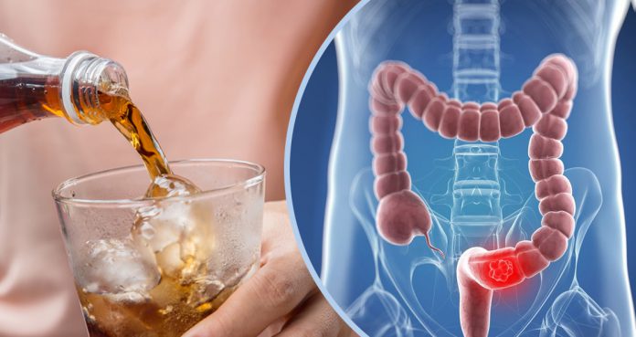 Sodas Promote Colon Cancer Tumor Growth