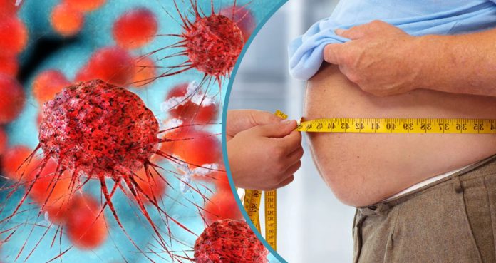 Obesity Linked To Cancer