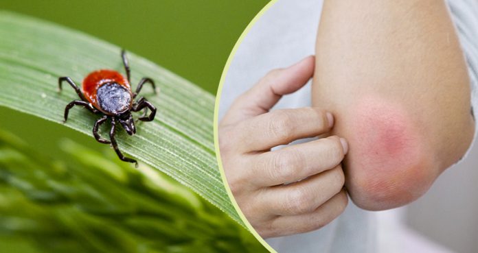 $100 Million to Combat Lyme Disease