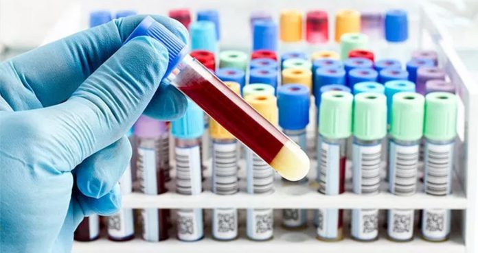 Blood Test Detect 12 Cancers Before Spread