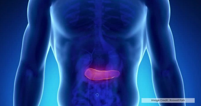 New Treatment Pancreatic Cancer Patients