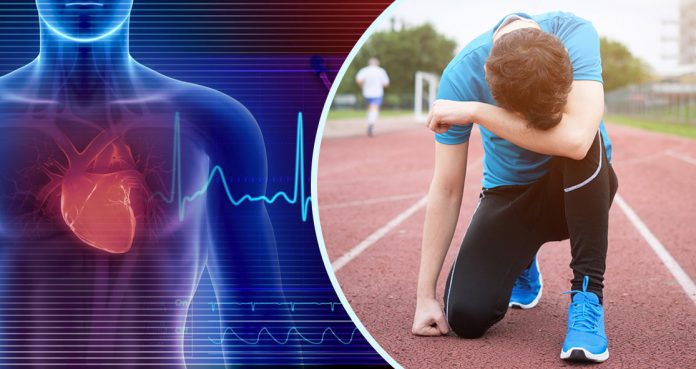 Prevent Sudden Cardiac Arrest Athletes