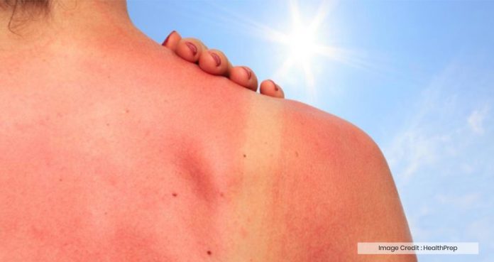 Skin Cancer Risk Increases