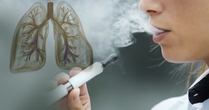 Lung-Illness-Related-To-Vaping-Started-Much-Earlier-Than-Reported